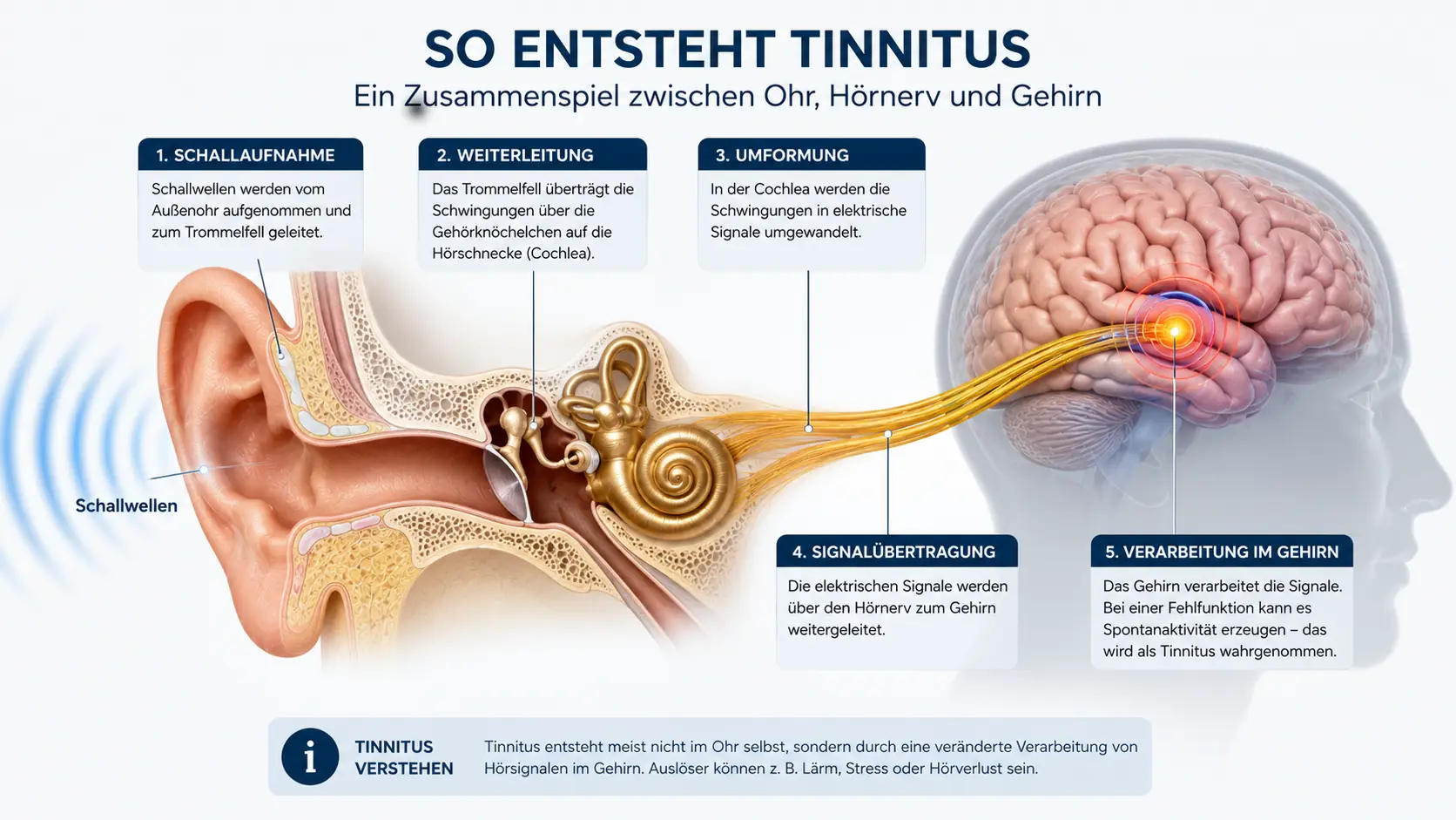 Schematische Darstellung von Ohr, Hörnerv und Gehirn zur Veranschaulichung möglicher Tinnitus Ursachen